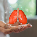 In COPD, Mepolizumab Appears to Reduce the Need for Systemic Corticosteroids